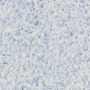 Жидкие обои Silk Plaster Рельеф (Relief) 326 1 кг Голубой