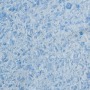 Жидкие обои Silk Plaster Виктория (Victoria) 717 1 кг Голубой